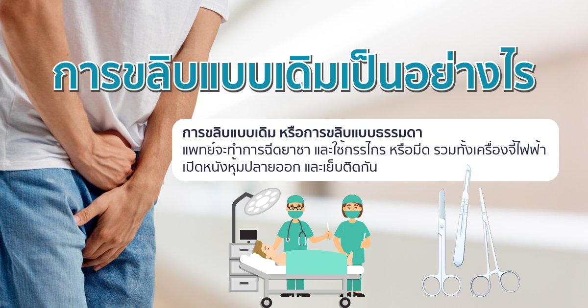 การขลิบแบบเดิม ขลิบมีกี่แบบ ขลิบไร้เลือด หมอเบียร์ Eternity Clinic