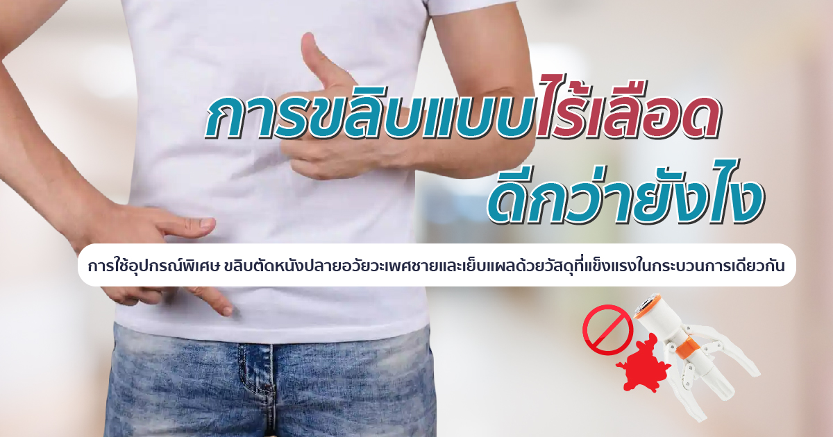 การขลิบแบบไร้เลือด ขลิบมีกี่แบบ ขลิบไร้เลือด หมอเบียร์ Eternity Clinic