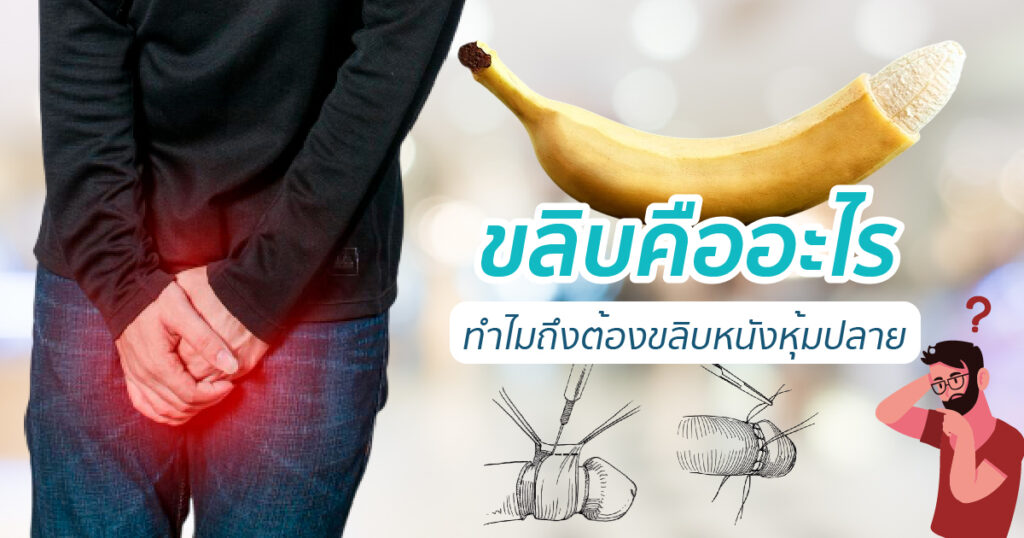 ขลิบคืออะไร