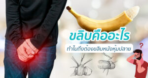 ขลิบคืออะไร