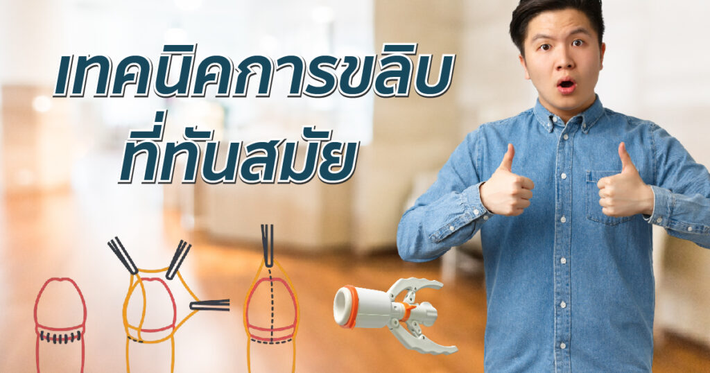 การขลิบที่ทันสมัย