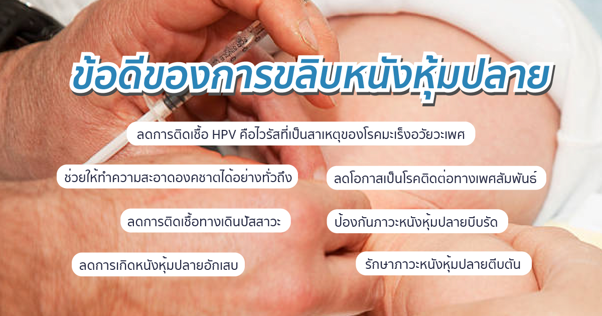 ข้อดีของการขลิบ