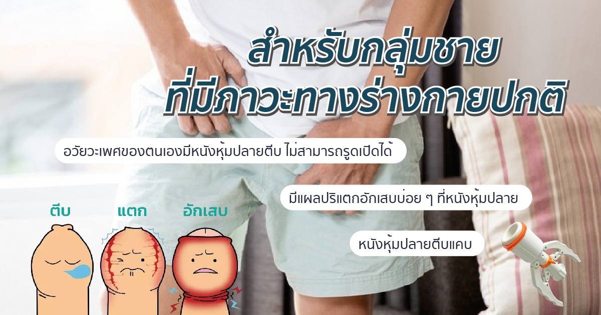 - eternityclinicdoctorbeer ผลคข้างเคียกจากการขลิบ