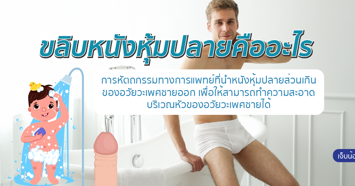 ขลิบหนังหุ้มปลาย