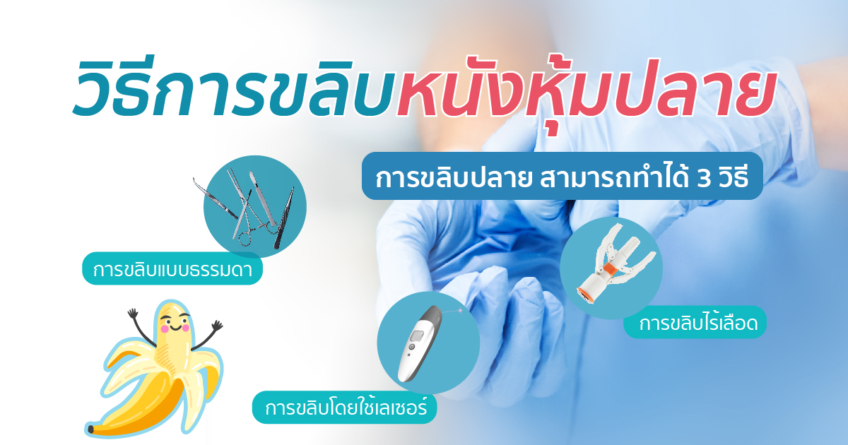 วิธีการขลิบหนังหุ้มปลาย