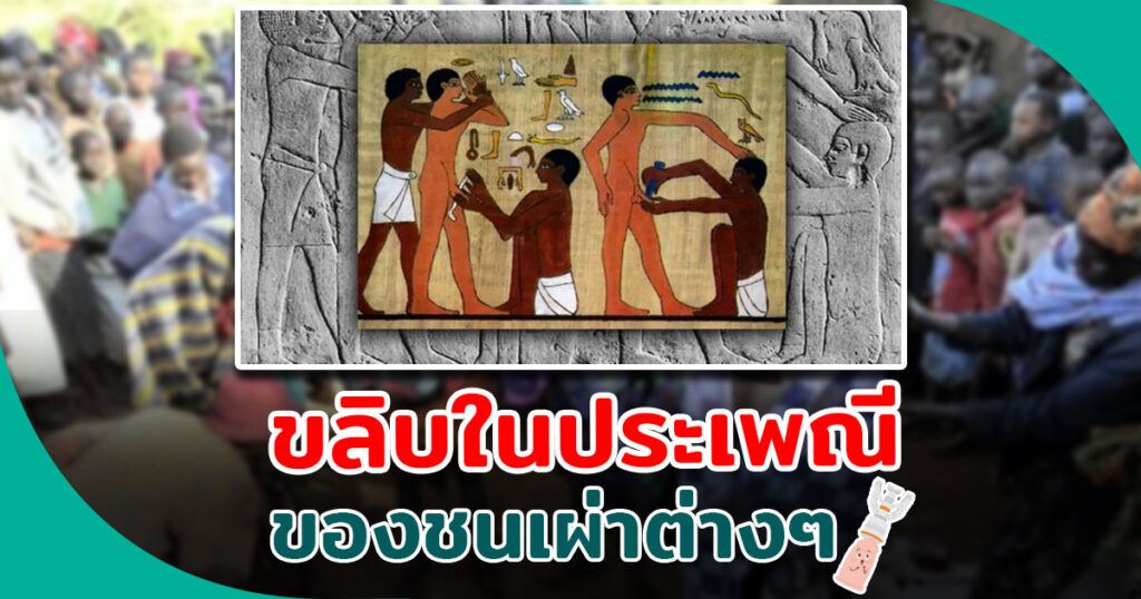 ขลิบไร้เลือด