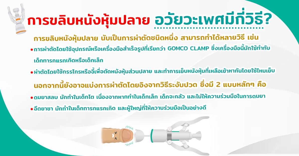 ขลิบไร้เลือด