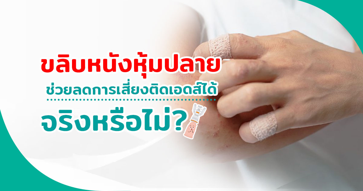 ขลิบหนังหุ้มปลาย