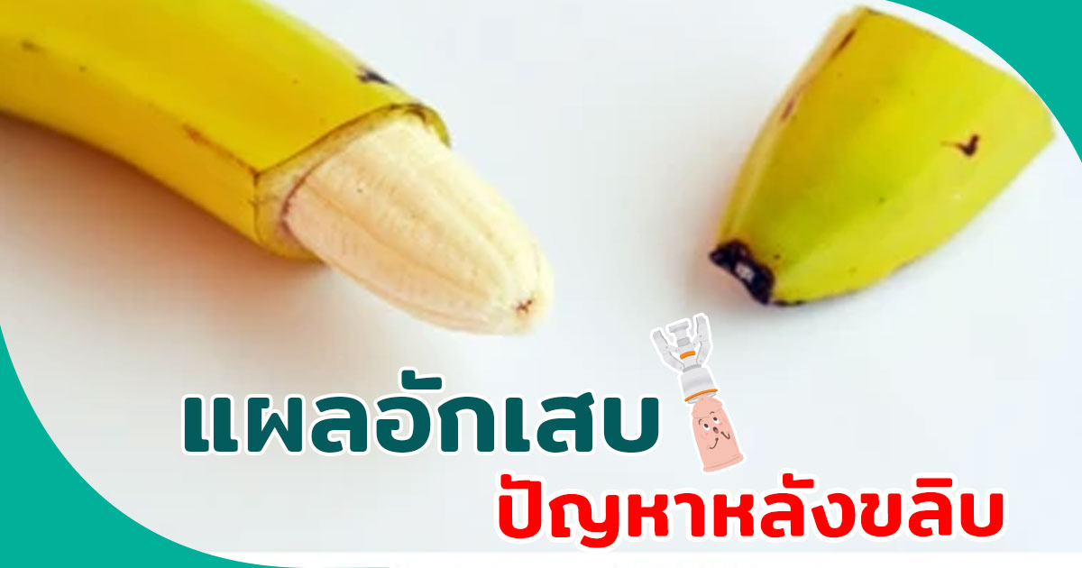 ขลิบไร้เลือด