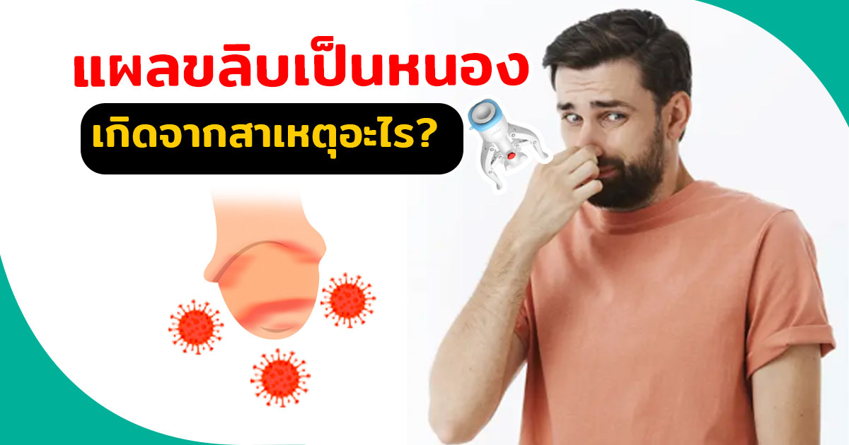 ขลิบไร้เลือด