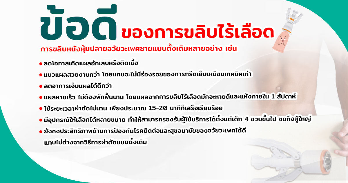 - eternityclinicdoctorbeer ขลิบไร้เลือด