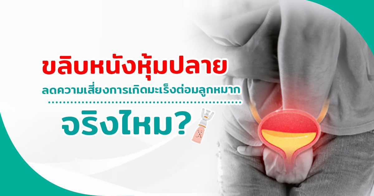 ขลิบหนังหุ้มปลาย