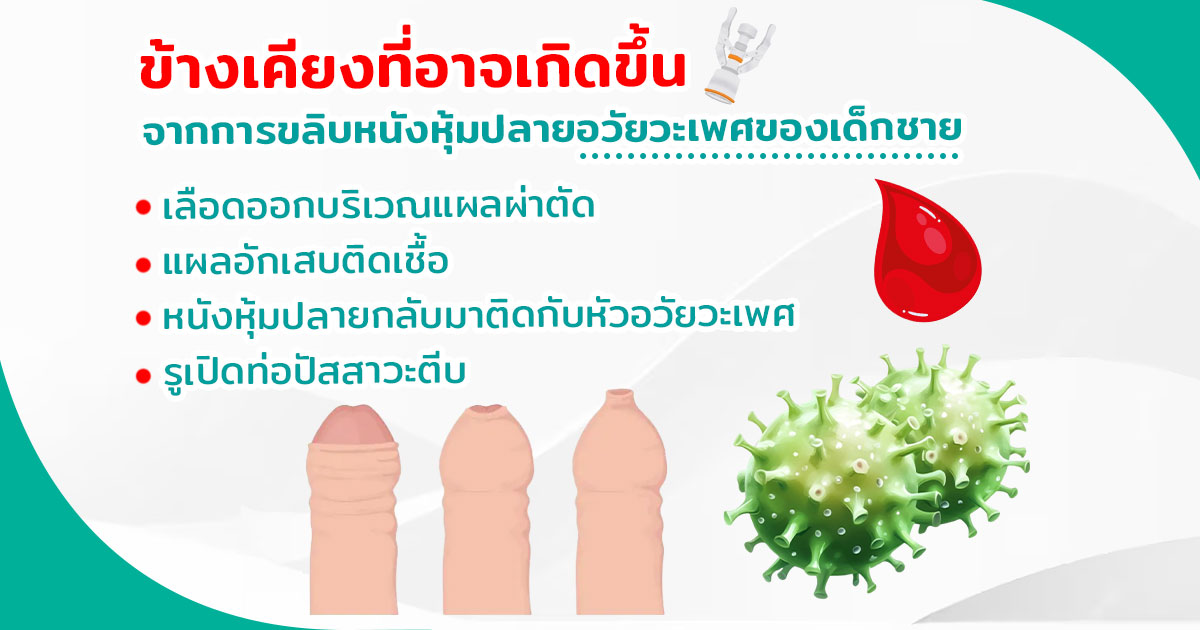 ขลิบไร้เลือด