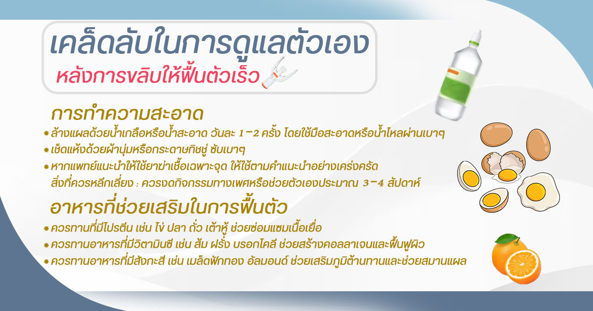 ขลิบน้องชาย